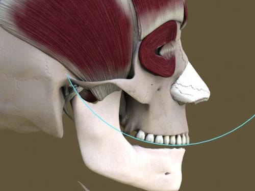 functional integration of porcelain veneers by San Francisco